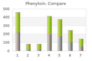 buy phenytoin cheap online