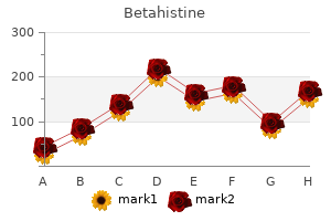 purchase betahistine 16mg on line