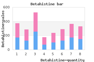 order 16 mg betahistine amex