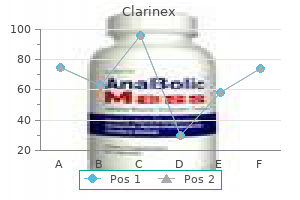 order clarinex