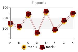 cheap finpecia 1 mg on-line