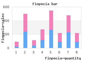 cheap 1 mg finpecia with mastercard