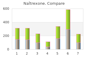 purchase naltrexone 50 mg otc