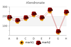 35mg alendronate sale